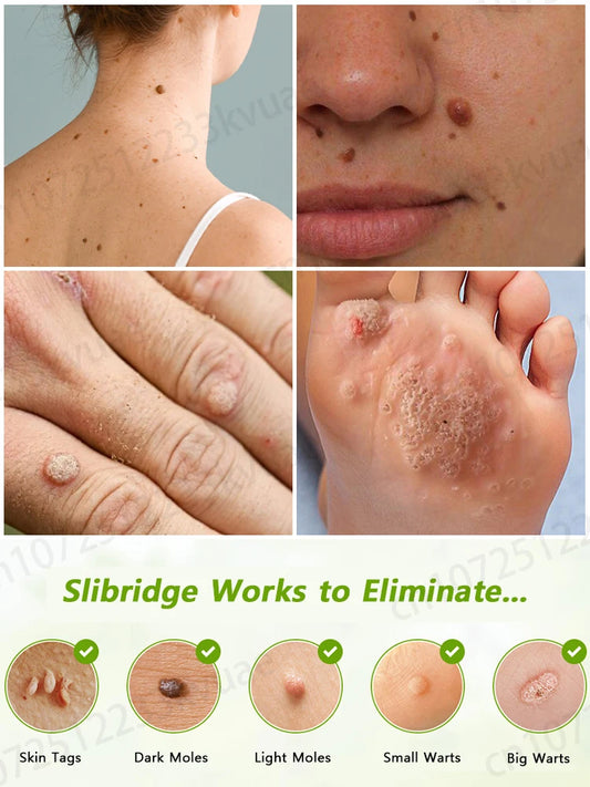 ᴸᵃˢᵉʳ ᵖᵉⁿ ᶠᵒʳ ʷᵃʳᵗ ʳᵉᵐᵒᵛᵃˡ⸴ ˢᵐᵃˡˡ ᵃⁿᵈ portable, can be used at any time