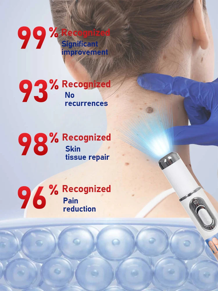 ᴸᵃˢᵉʳ ᵖᵉⁿ ᶠᵒʳ ʷᵃʳᵗ ʳᵉᵐᵒᵛᵃˡ⸴ ˢᵐᵃˡˡ ᵃⁿᵈ portable, can be used at any time