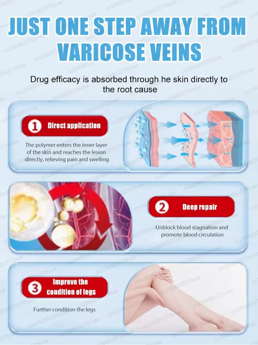 Bʟᴜᴇ ʟɪɢʜᴛ ᴠᴇɪɴ ᴘᴇɴ ᴇᴀsɪʟʏ ʀᴇᴍᴏᴠᴇs ᴠᴀʀɪᴄᴏsᴇ ᴠᴇɪɴs ɪɴ ᴛʜᴇ ʙᴏᴅʏ