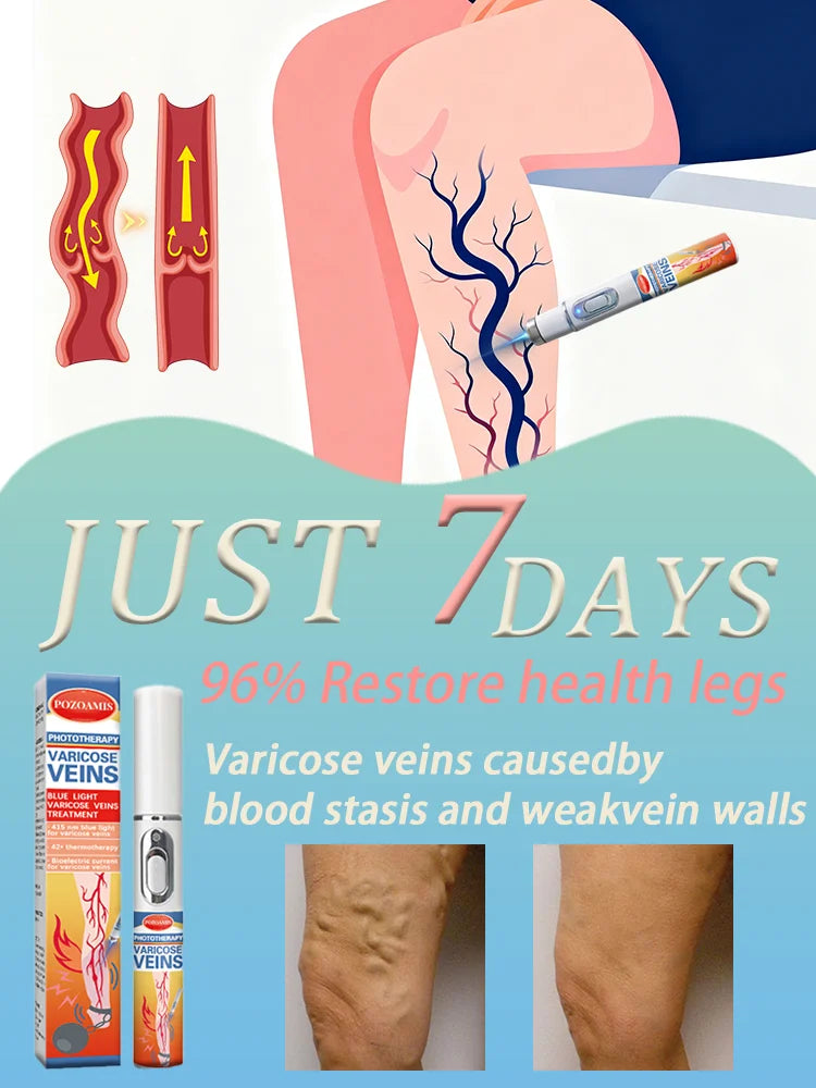 Bʟᴜᴇ ʟɪɢʜᴛ ᴠᴇɪɴ ᴘᴇɴ ᴇᴀsɪʟʏ ʀᴇᴍᴏᴠᴇs ᴠᴀʀɪᴄᴏsᴇ ᴠᴇɪɴs ɪɴ ᴛʜᴇ ʙᴏᴅʏ