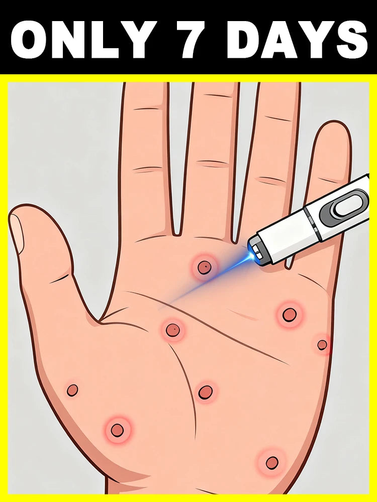 ᴸᵃˢᵉʳ ᵖᵉⁿ ᶠᵒʳ ʷᵃʳᵗ ʳᵉᵐᵒᵛᵃˡ⸴ ˢᵐᵃˡˡ ᵃⁿᵈ portable, can be used at any time