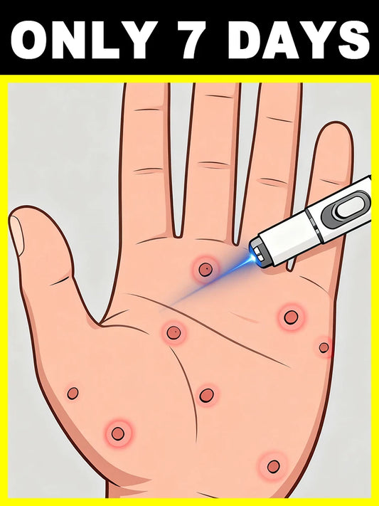 ᴸᵃˢᵉʳ ᵖᵉⁿ ᶠᵒʳ ʷᵃʳᵗ ʳᵉᵐᵒᵛᵃˡ⸴ ˢᵐᵃˡˡ ᵃⁿᵈ portable, can be used at any time